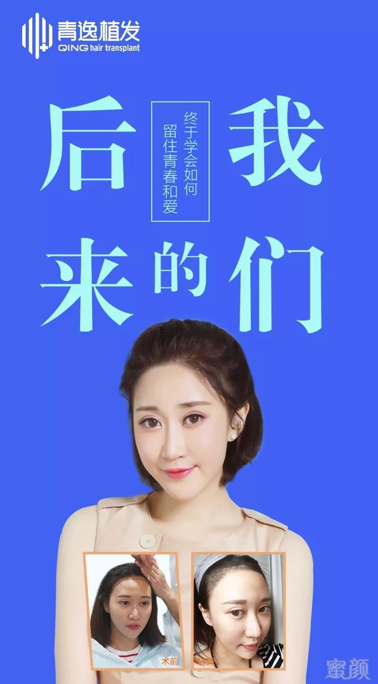 https://img.miyanlife.com/mnt/timg/180708/113911D55-3.jpg