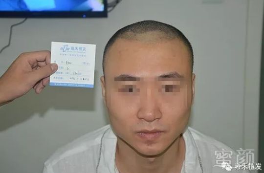 https://img.miyanlife.com/mnt/timg/180708/113Z93427-3.jpg