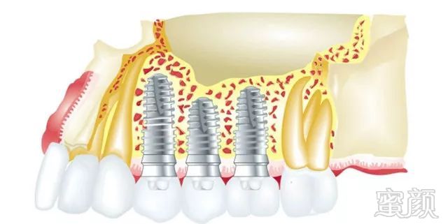 https://img.miyanlife.com/mnt/timg/180708/11420S296-5.jpg