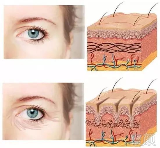 https://img.miyanlife.com/mnt/timg/180708/12043ME0-5.jpg