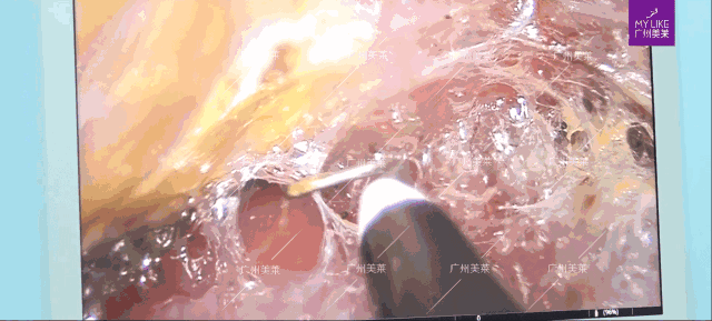 https://img.miyanlife.com/mnt/timg/180708/12105533a-6.gif