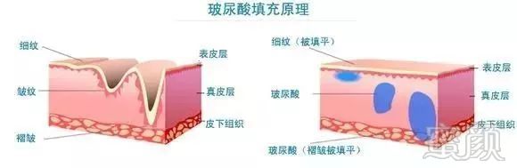 https://img.miyanlife.com/mnt/timg/180708/1226363H3-2.jpg