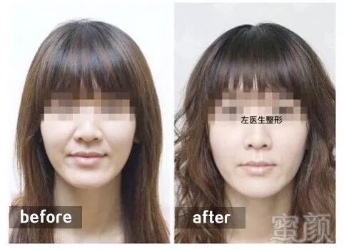 https://img.miyanlife.com/mnt/timg/180708/12263KA3-3.jpg
