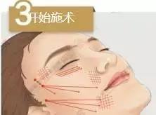 https://img.miyanlife.com/mnt/timg/180708/122640AT-8.jpg