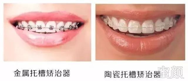 https://img.miyanlife.com/mnt/timg/180708/122Q023Y-3.jpg