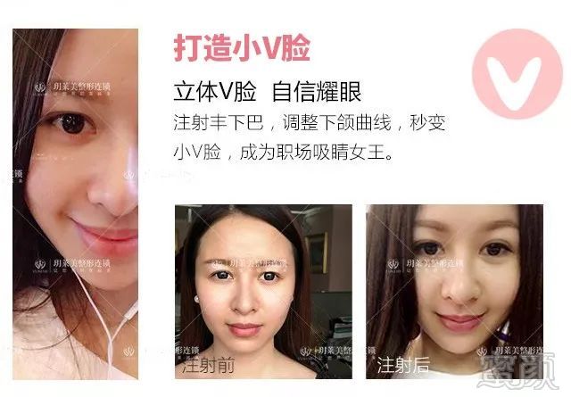 https://img.miyanlife.com/mnt/timg/180708/1233214H7-4.jpg