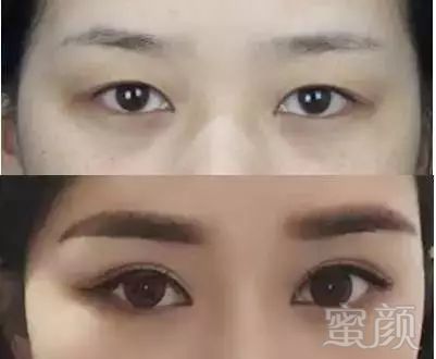 https://img.miyanlife.com/mnt/timg/180708/123333AR-3.jpg