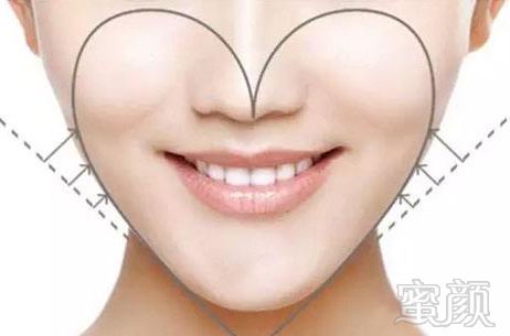 https://img.miyanlife.com/mnt/timg/180708/13025154G-2.jpg