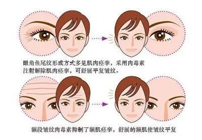 https://img.miyanlife.com/mnt/timg/180708/132404D46-12.jpg