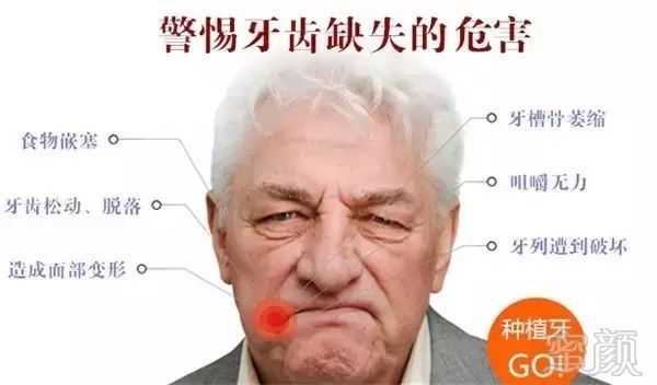 https://img.miyanlife.com/mnt/timg/180708/1324591V1-2.jpg