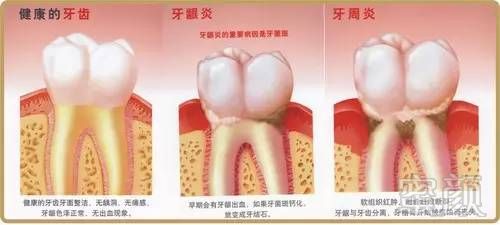 https://img.miyanlife.com/mnt/timg/180708/13245a420-1.jpg