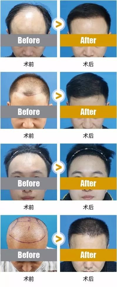 https://img.miyanlife.com/mnt/timg/180708/132G93013-6.jpg