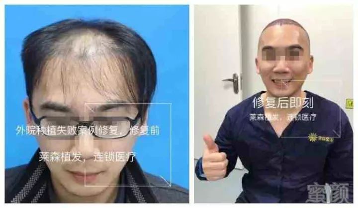 https://img.miyanlife.com/mnt/timg/180708/132G95345-5.jpg