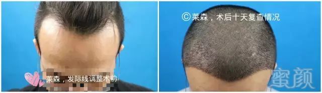 https://img.miyanlife.com/mnt/timg/180708/132GT415-0.jpg