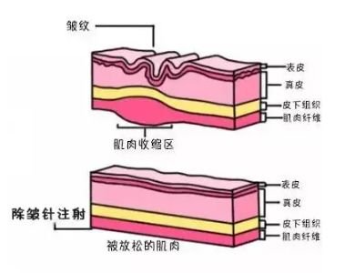 https://img.miyanlife.com/mnt/timg/180708/132SR612-7.jpg