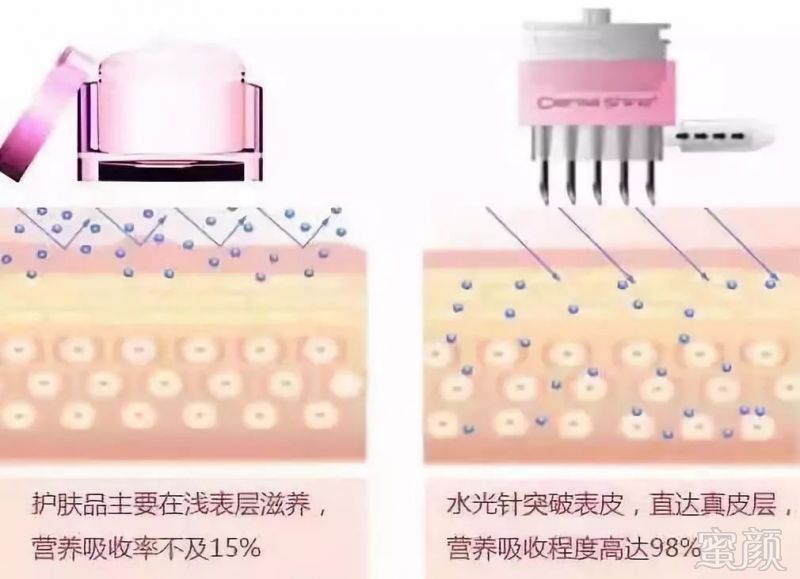 https://img.miyanlife.com/mnt/timg/180708/13300013V-4.jpg