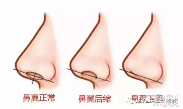 https://img.miyanlife.com/mnt/timg/180709/11331011Y-5.jpg
