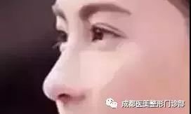 https://img.miyanlife.com/mnt/timg/180709/1133105511-8.jpg