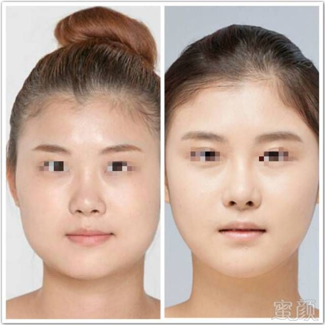 https://img.miyanlife.com/mnt/timg/180709/1134242248-10.jpg
