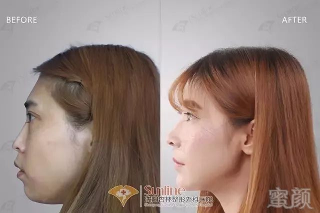 https://img.miyanlife.com/mnt/timg/180709/114JGA6-1.jpg