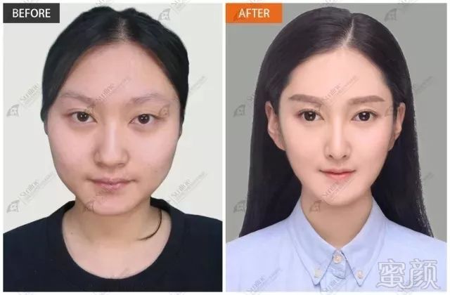 https://img.miyanlife.com/mnt/timg/180709/114JQ221-5.jpg