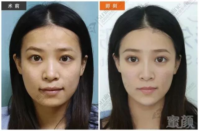 https://img.miyanlife.com/mnt/timg/180709/114JR131-7.jpg