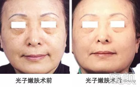 https://img.miyanlife.com/mnt/timg/180709/1159351604-6.jpg