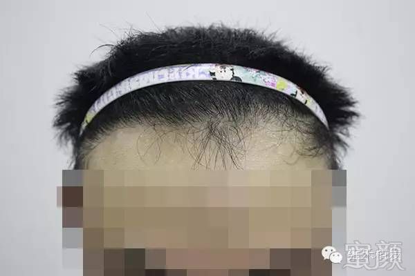 https://img.miyanlife.com/mnt/timg/180709/12111155T-5.jpg