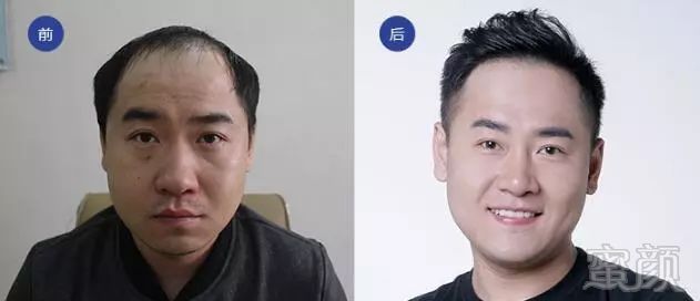 https://img.miyanlife.com/mnt/timg/180709/121235M45-0.jpg