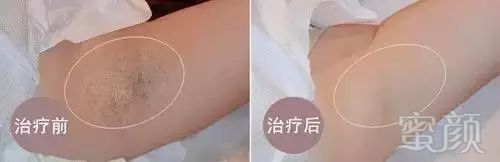 https://img.miyanlife.com/mnt/timg/180709/1223044348-8.jpg
