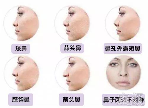 https://img.miyanlife.com/mnt/timg/180709/123I610Q-7.jpg