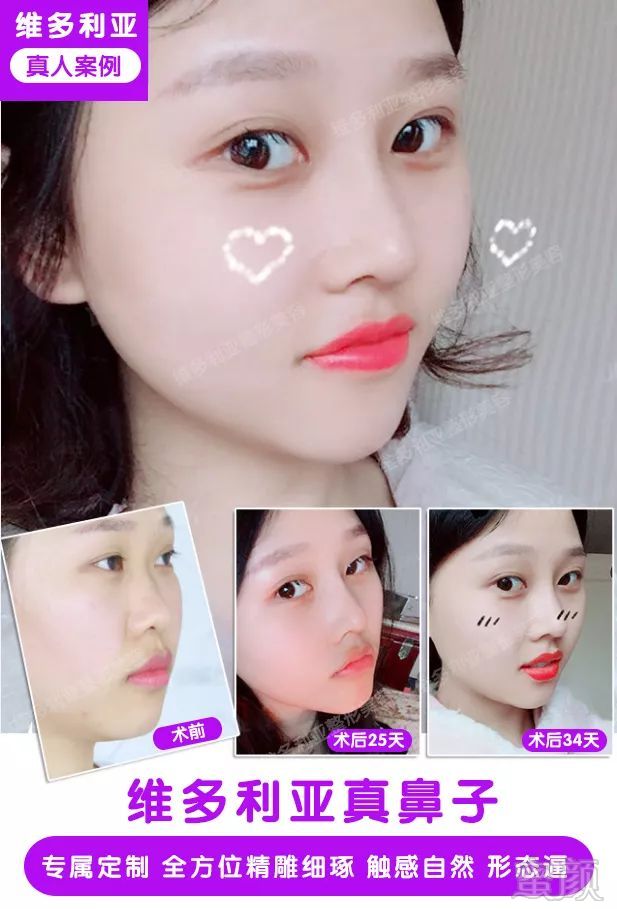 https://img.miyanlife.com/mnt/timg/180709/123IB527-8.jpg