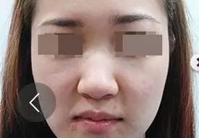 https://img.miyanlife.com/mnt/timg/180710/16211aU6-2.jpg