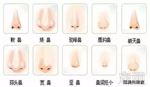 https://img.miyanlife.com/mnt/timg/180710/1621421620-10.jpg