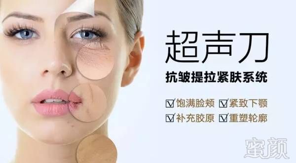 https://img.miyanlife.com/mnt/timg/180710/1A31a4E-4.jpg