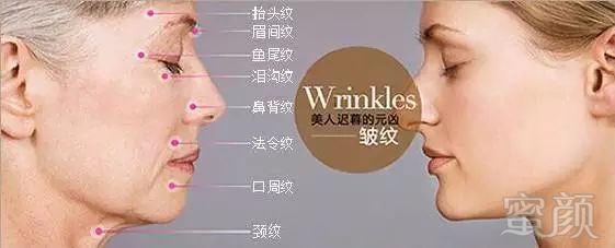 https://img.miyanlife.com/mnt/timg/180710/1AA24Q2-1.jpg