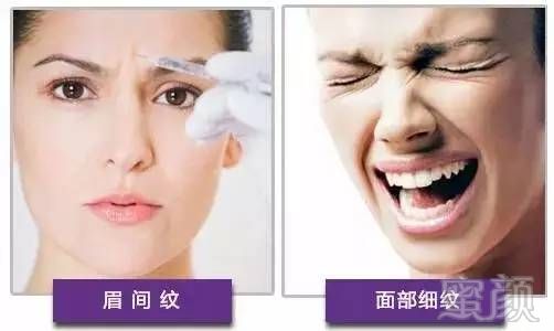https://img.miyanlife.com/mnt/timg/180710/1AACL5-4.jpg