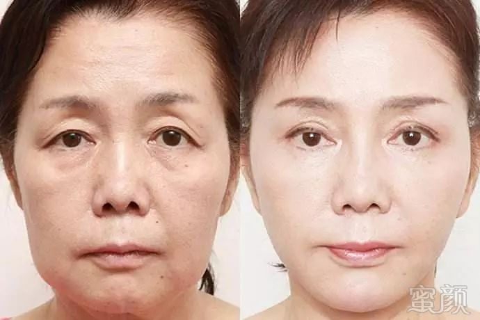 https://img.miyanlife.com/mnt/timg/180710/1ARS154-3.jpg