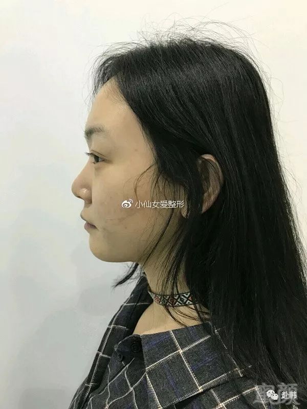 https://img.miyanlife.com/mnt/timg/180710/1R952IX-0.jpg
