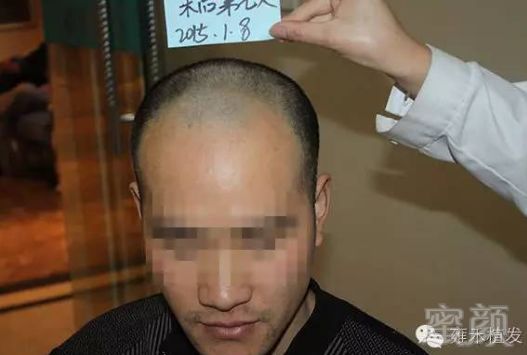 https://img.miyanlife.com/mnt/timg/180710/1U32A949-4.jpg