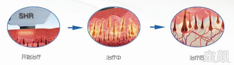 https://img.miyanlife.com/mnt/timg/180710/1U9413443-0.jpg