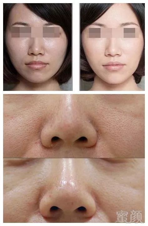 https://img.miyanlife.com/mnt/timg/180710/1U9424492-6.jpg