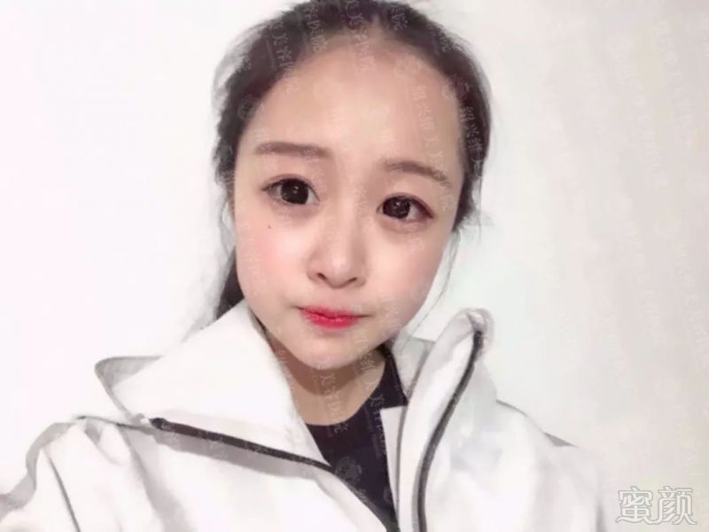 https://img.miyanlife.com/mnt/timg/180712/1155141K2-0.jpg