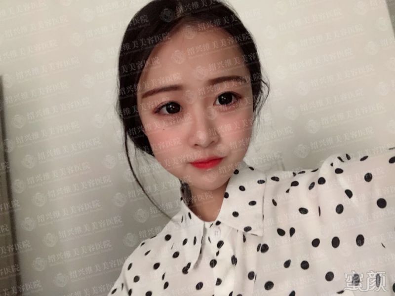 https://img.miyanlife.com/mnt/timg/180712/1155191V5-5.jpg