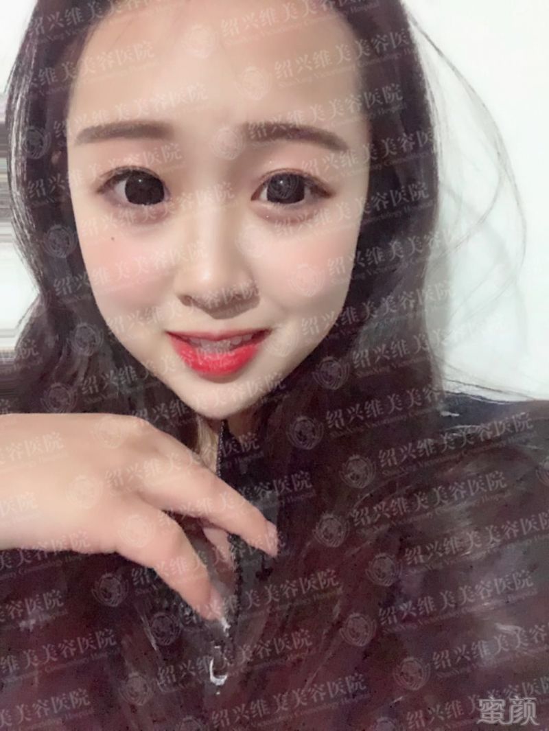 https://img.miyanlife.com/mnt/timg/180712/11551K357-3.jpg