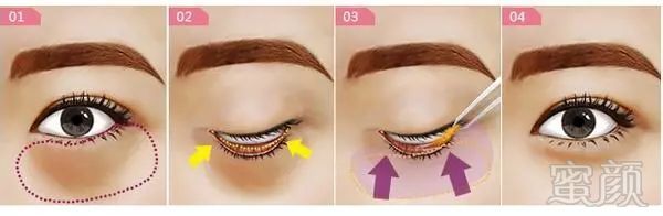 https://img.miyanlife.com/mnt/timg/180712/11553IC2-1.jpg