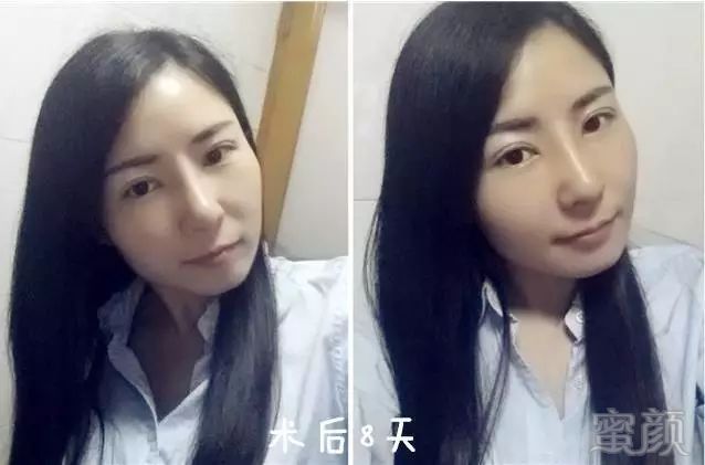 https://img.miyanlife.com/mnt/timg/180712/1205154231-6.jpg