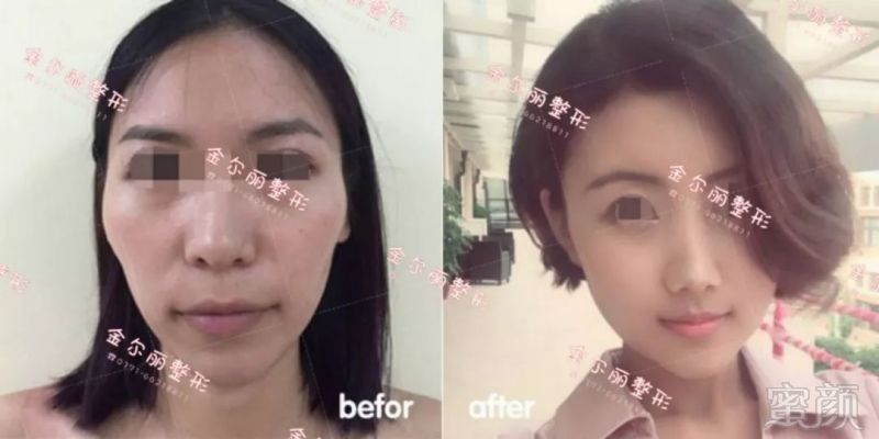 https://img.miyanlife.com/mnt/timg/180712/12093S634-0.jpg