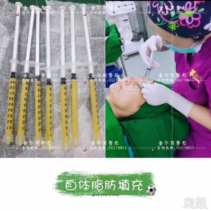 https://img.miyanlife.com/mnt/timg/180712/1209403362-3.jpg