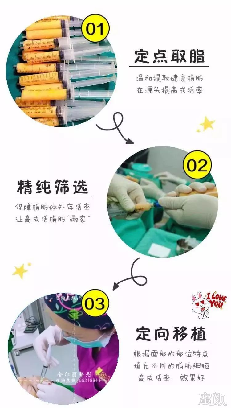https://img.miyanlife.com/mnt/timg/180712/120942L61-4.jpg